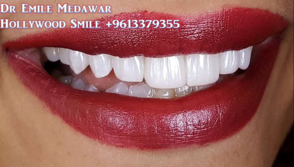 best dentist lebanon beirut