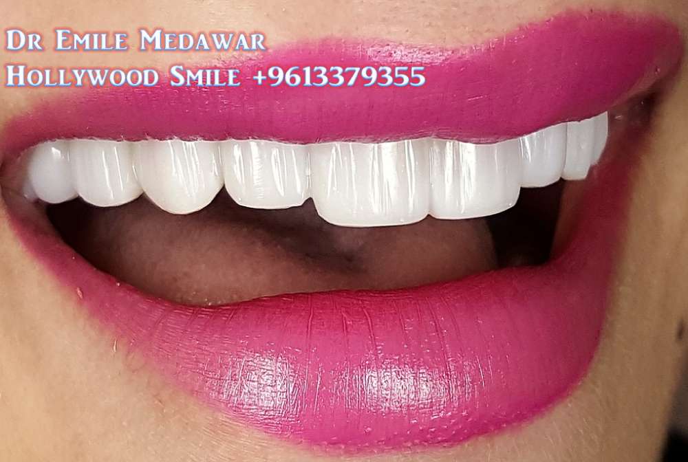 denrtist in lebanon beirut