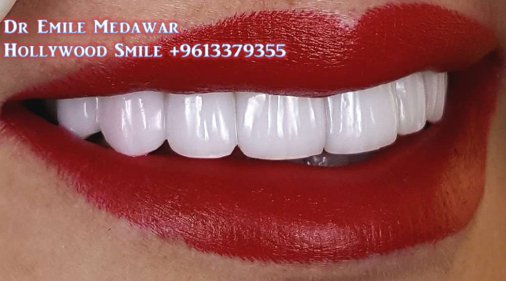 dental clinic lebanon