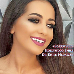 dentist veneers beirut lebanon