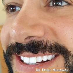 Hollywood Smile lebanon beirut