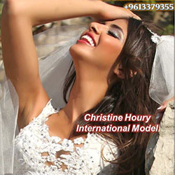 top veneers in Lebanon