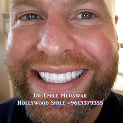 dentist in lebanon beirut