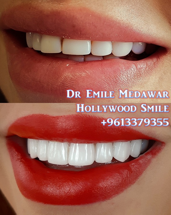 فينيرز إيماكس لبنان